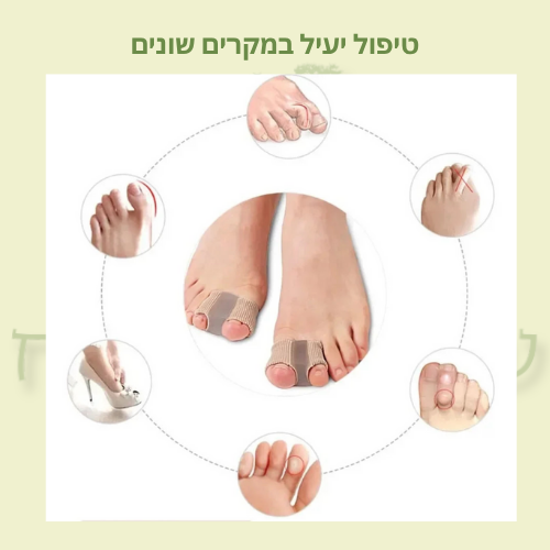 מפריד בהונות לטיפול בבוהן קלובה (Bunion Toe)