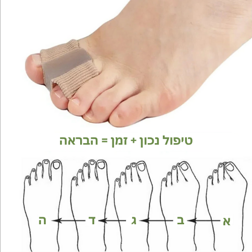 מפריד בהונות לטיפול בבוהן קלובה (Bunion Toe)